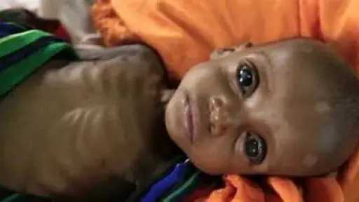 التغذية والدايت