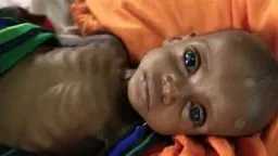 التغذية والدايت