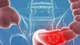 التغذية والدايت