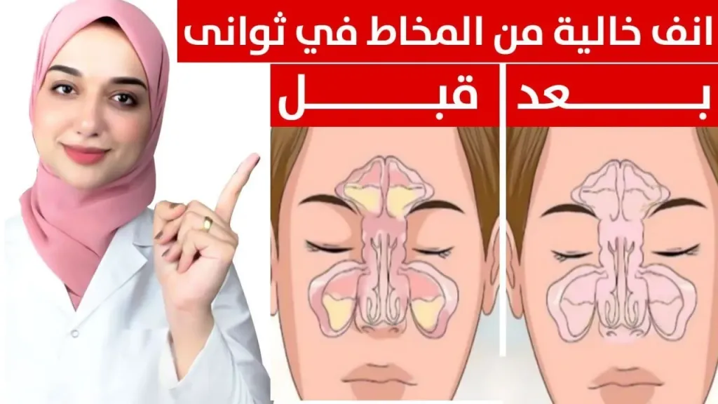 انسداد الجيوب الأنفية