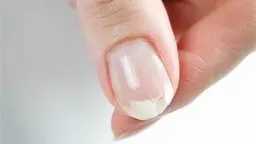 التغذية والدايت