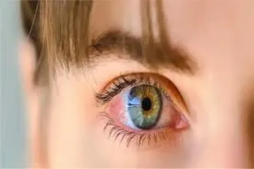 ارتعاش العين