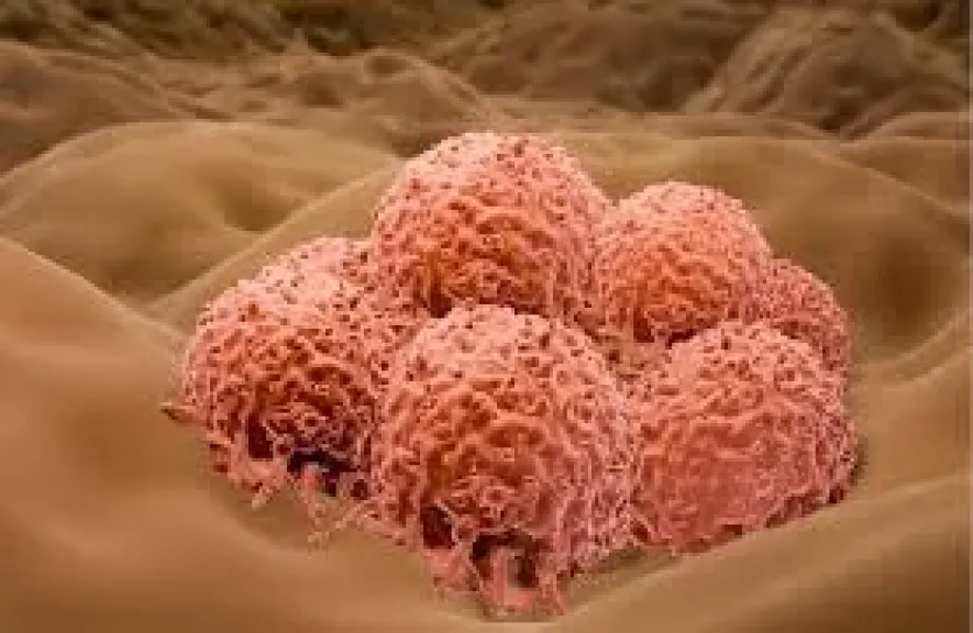 ابتكار رقعة حرارية لعلاج سرطان الجلد