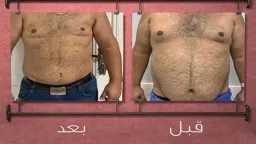 الصحة