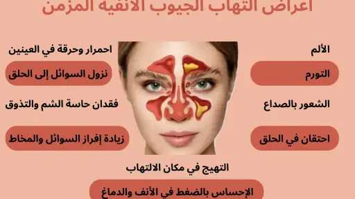 الأخبار