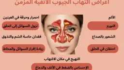 الأخبار
