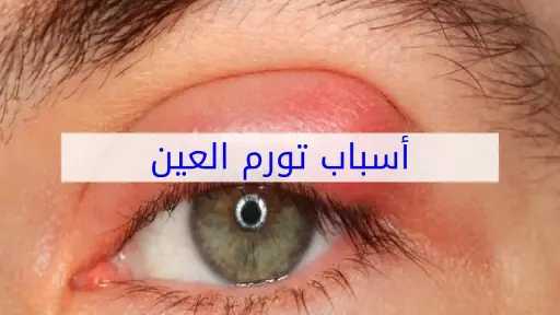 الأخبار
