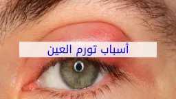 الأخبار
