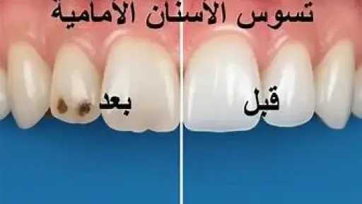 الأخبار