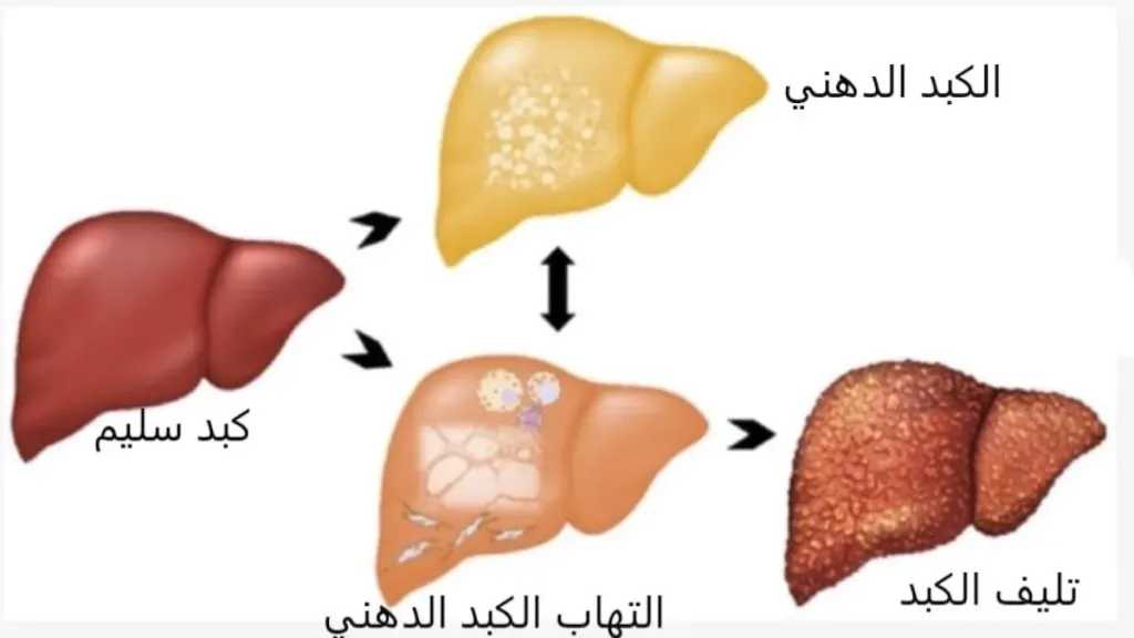 الأخبار