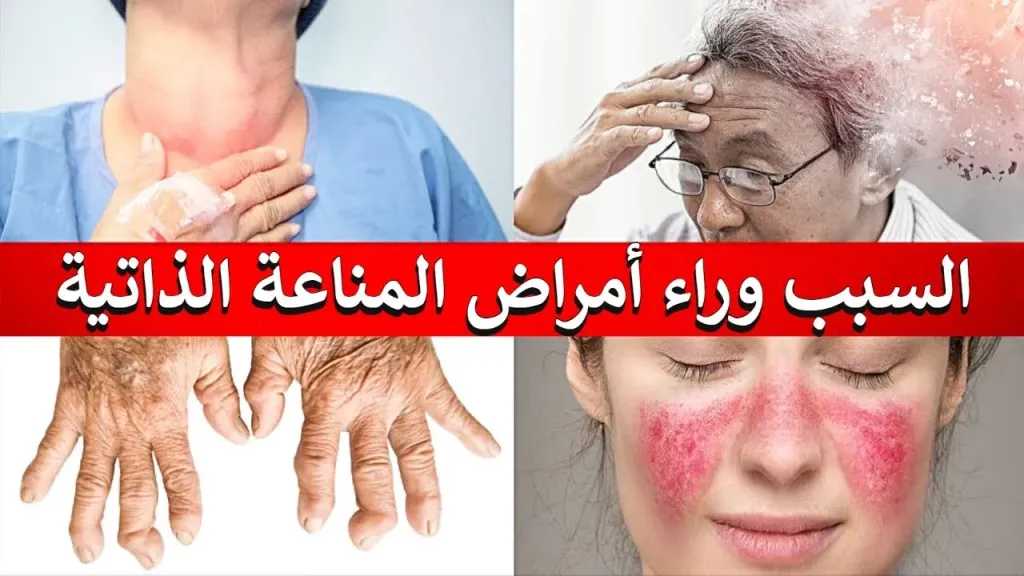 الأخبار
