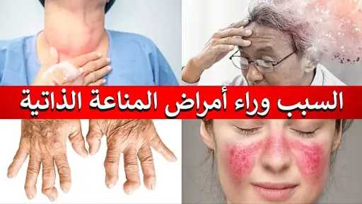 الأخبار