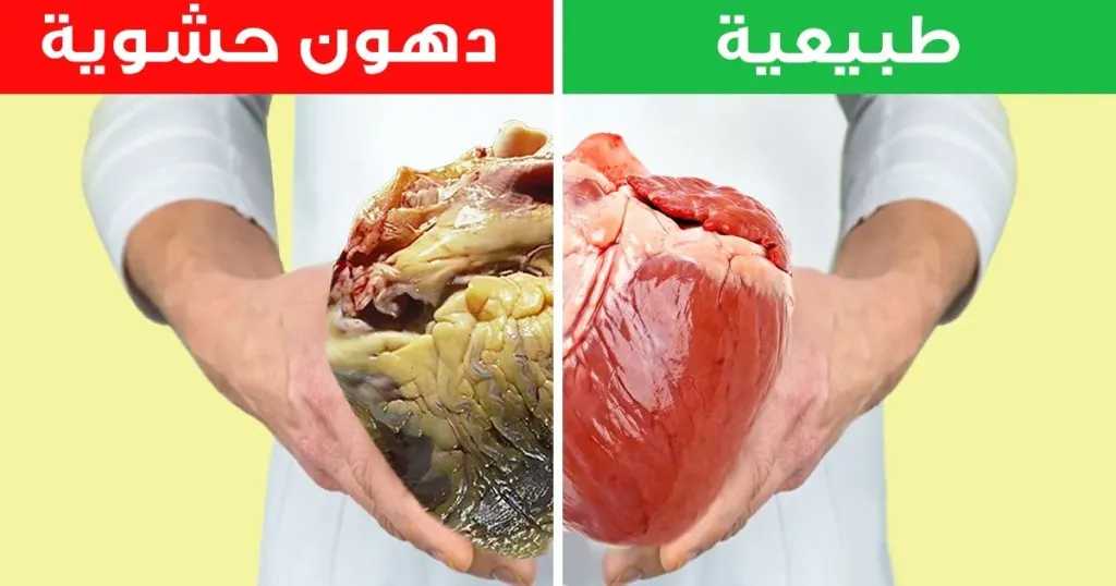 الصحة