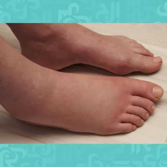 الأخبار