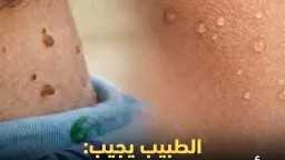الصحة