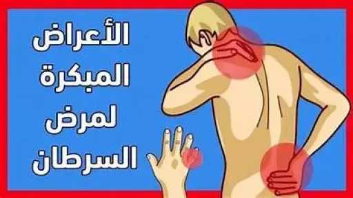الأخبار