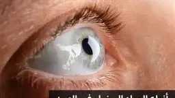 الأخبار