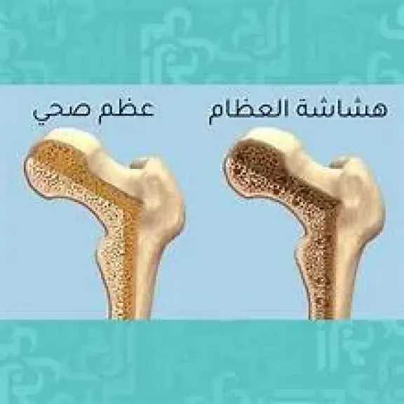 الأخبار