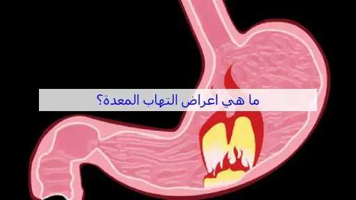 الأخبار