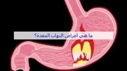 الأخبار