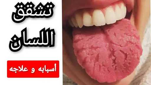 الأخبار