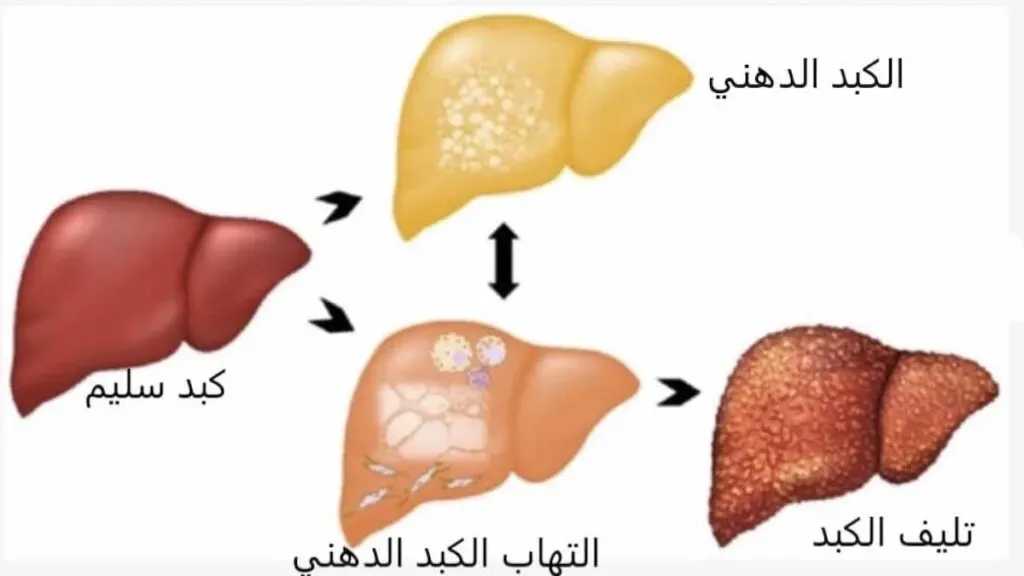 الأدوية