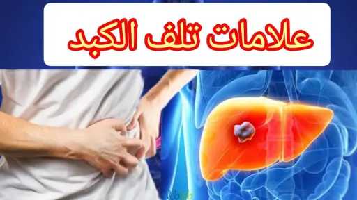 الأخبار