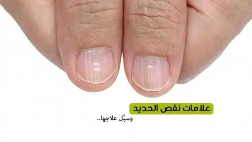 الأخبار