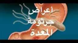 الأخبار