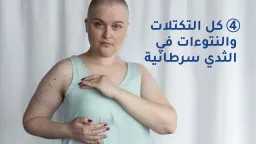 الصحة