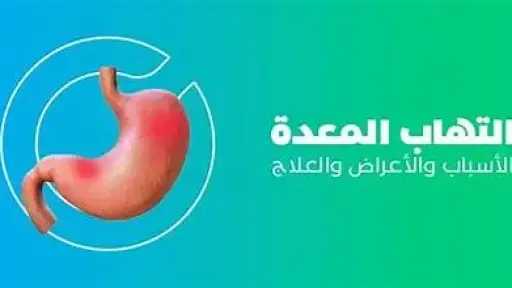 الأخبار