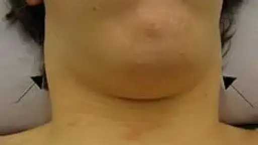 الأخبار