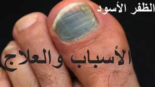 الأخبار