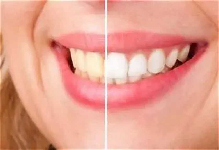 الأخبار