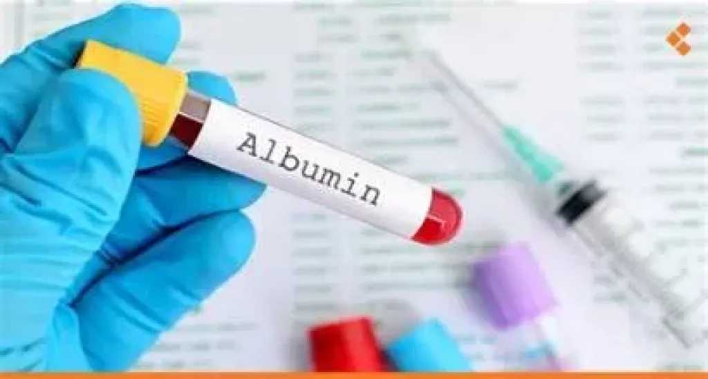 الأخبار
