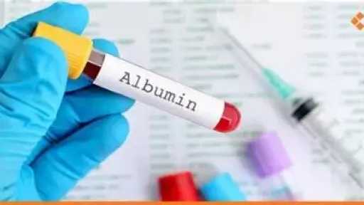 الأخبار