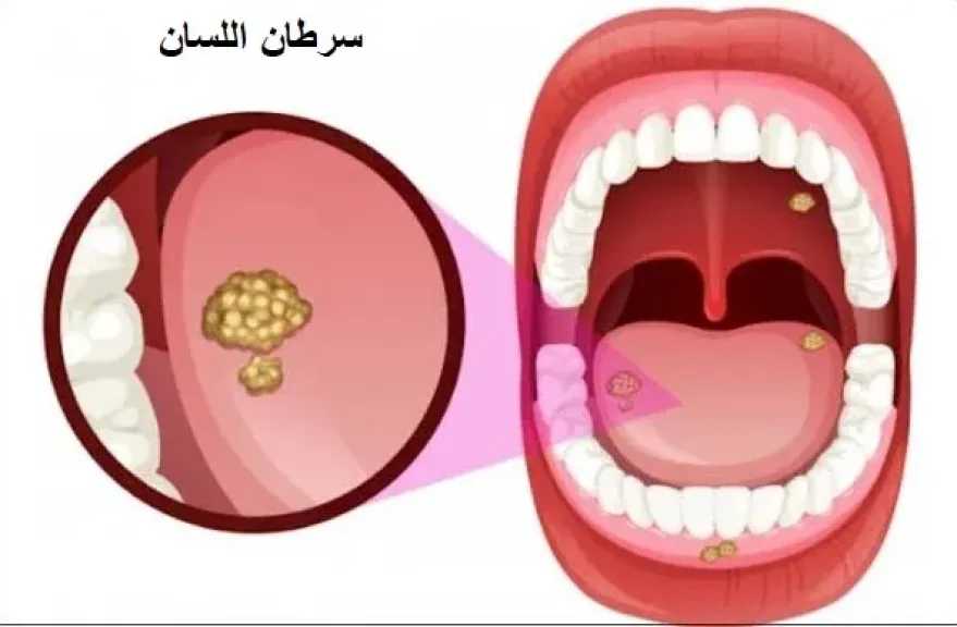 الأخبار
