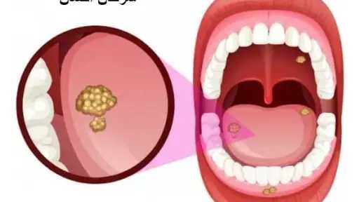 الأخبار