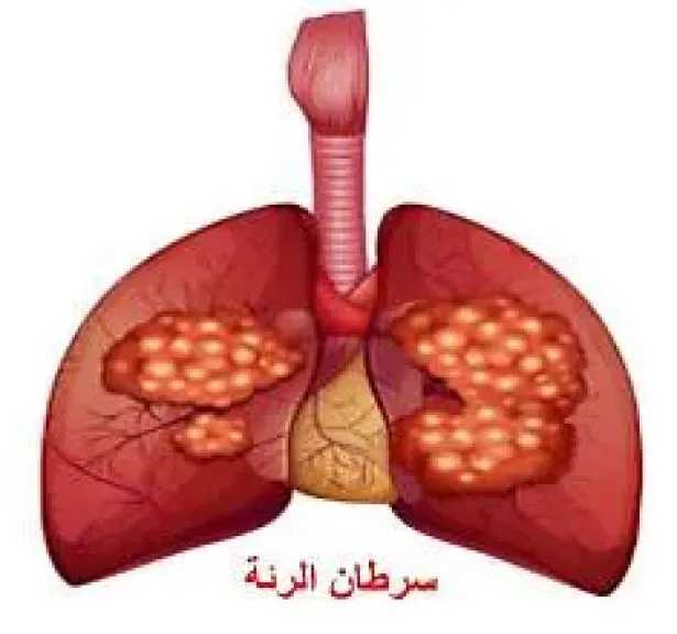 الأخبار