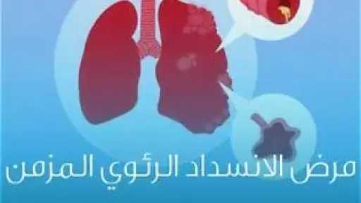 الأخبار