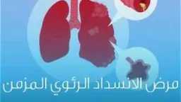 الأخبار
