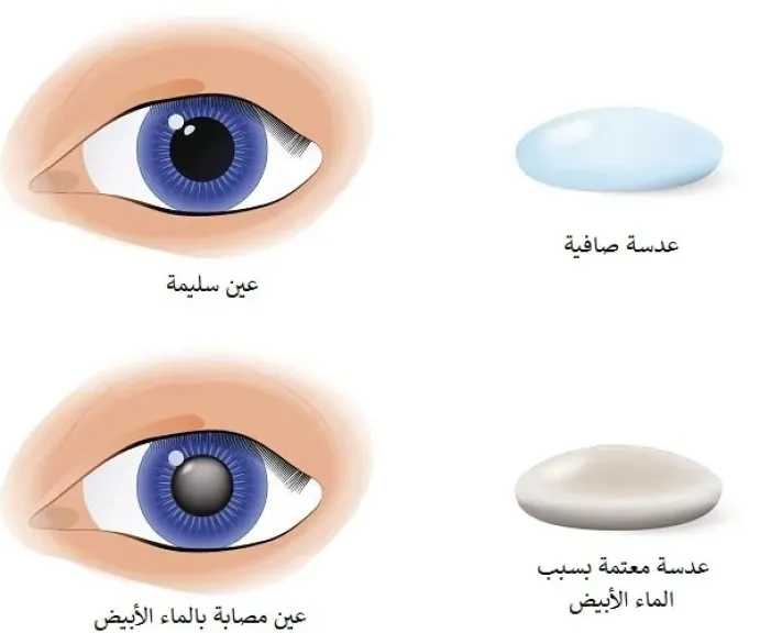 الأخبار