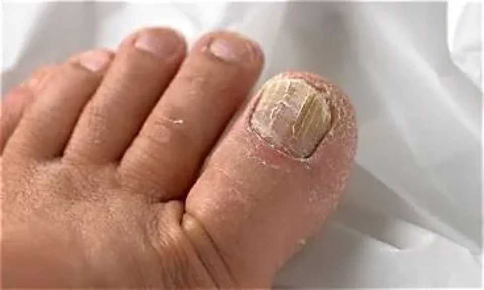 الأخبار