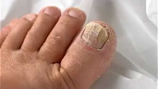 الأخبار