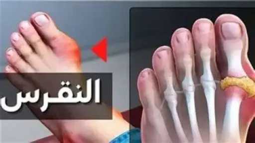 الأخبار