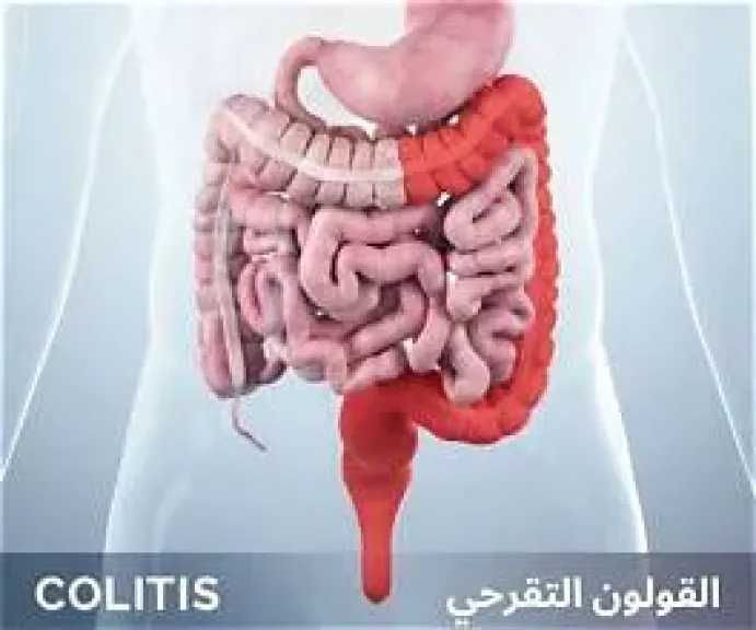الأخبار
