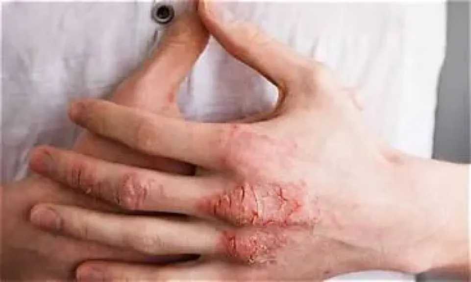 الأخبار