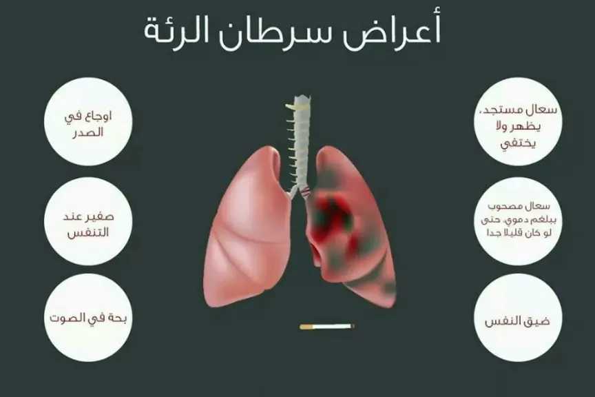الأخبار