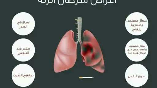الأخبار