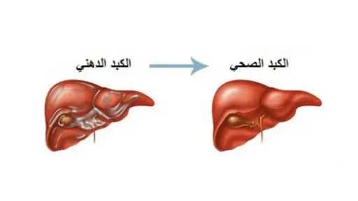 التغذية والدايت